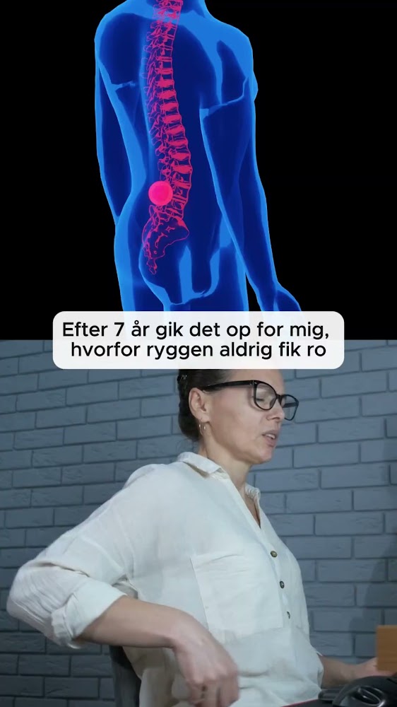 Når rygsmerter bliver en del af hverdagen