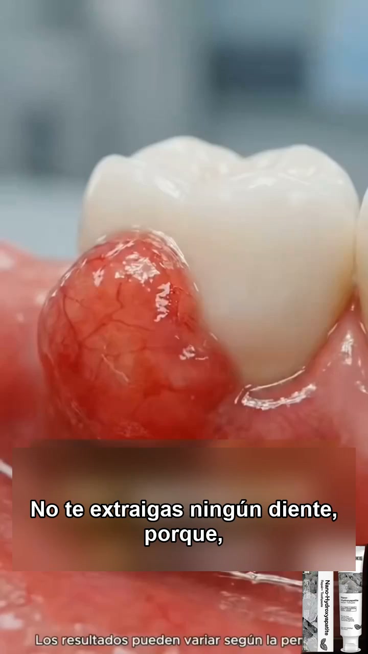 ¿Caliente, frío, ácido? ¡Vuelve a comer sin miedo!