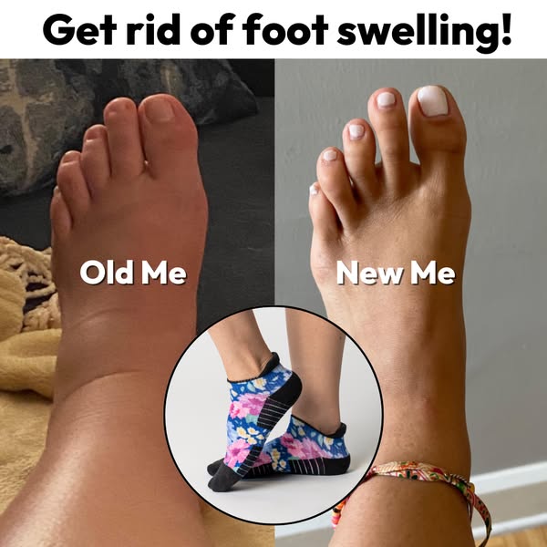 Get rid of Foot Swelling Today!