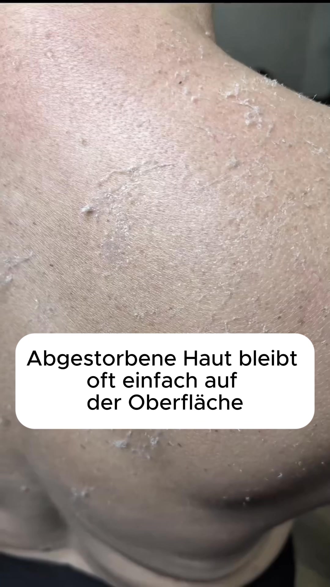 Kostenlose Lieferung