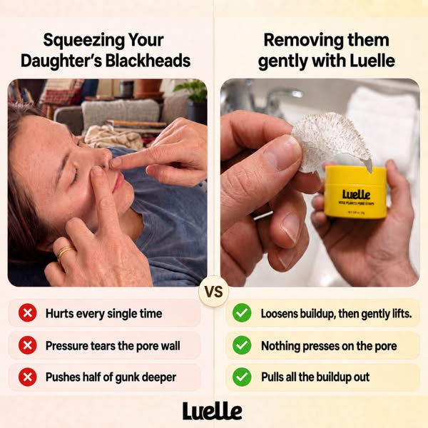 Eliminate Clogged Pores - Fast