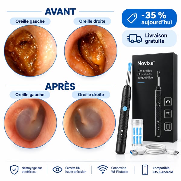 35 % AUJOURD’HUI + LIVRAISON GRATUITE