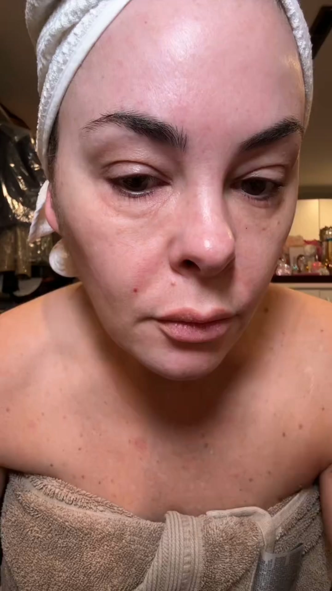 Why Women 50+ Are Choosing This Over Botox