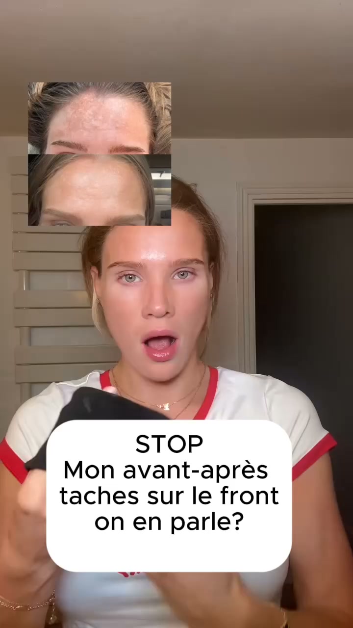 Retinal Shot à -50% · Aujourd'hui seulement