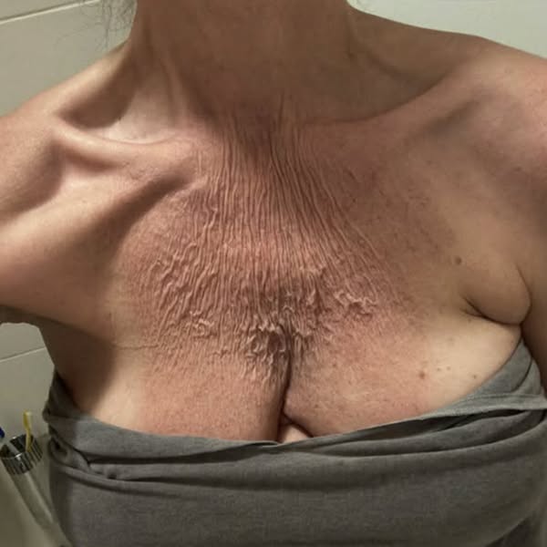 Dermatologist Said There Was Nothing to Be Done. She Was Wrong