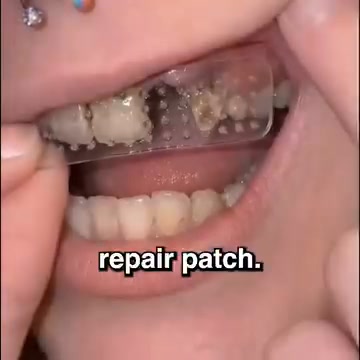 Tideglusib Tooth & Gum Repair Fast-Dissolving Oral Strips
