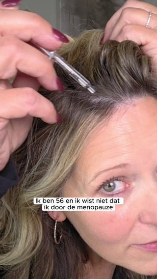 Gezond haar begint bij je hoofdhuid