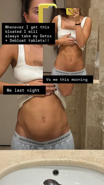 NUTRITIONIST-FORMULATED BLOATING SUPPORT