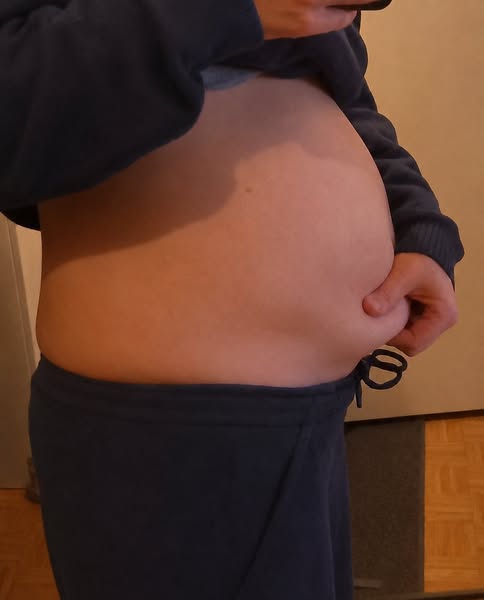 I Finally Deflated My “Endo Belly”