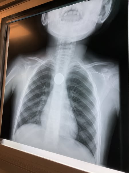 Il y avait un médecin à la table. Ce n'était pas suffisant.