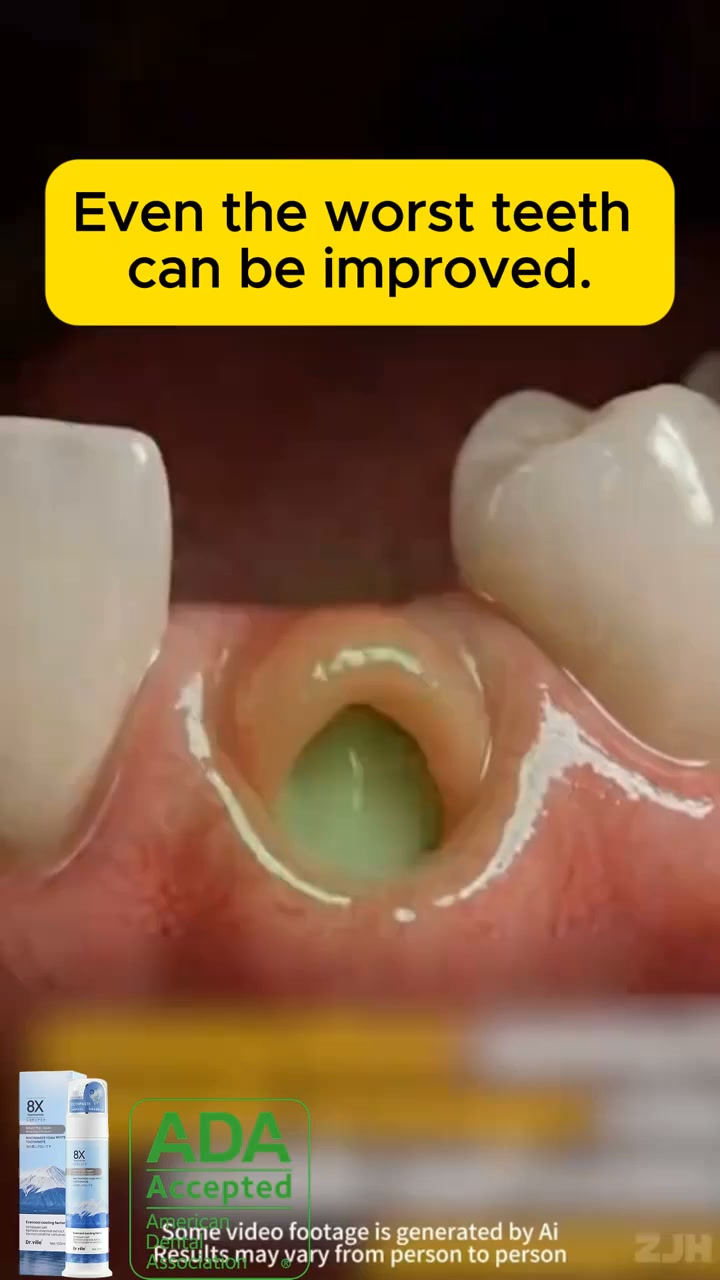 Repair Receding Gums & Loose Teeth in 7 Days! (Buy 2 Get 1 FREE)