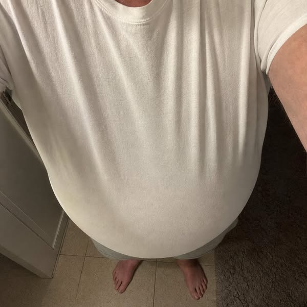 Doctors Told Him His Fatty Liver Was Incurable For 25 Years...