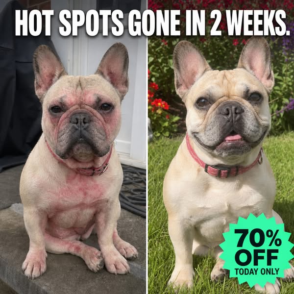 CLAIM 70% OFF + FREE Shipping