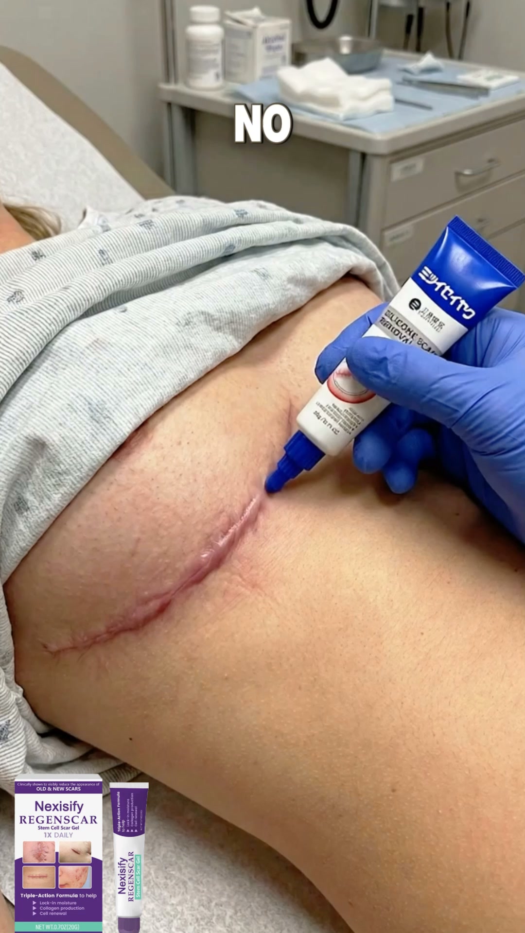 Say Goodbye to Stubborn Old & New Scars