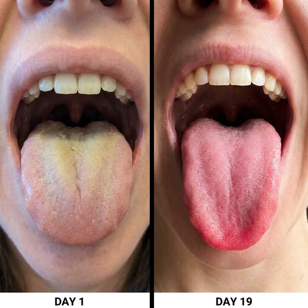 Resolving my bad breath saved my marriage.