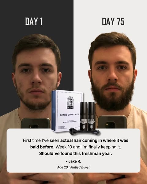 Real Beard Growth Takes Time — This Is What It Looks Like