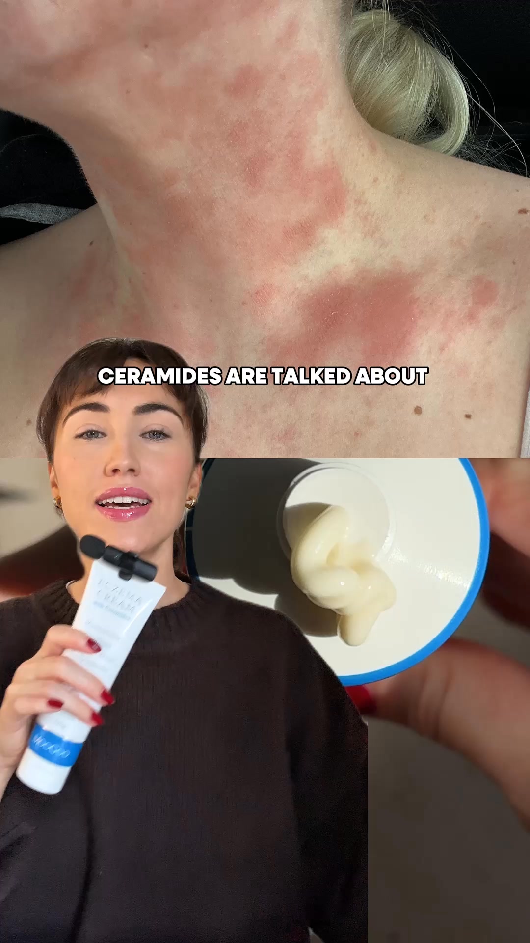Strengthen Your Skin Barrier In The Cold
