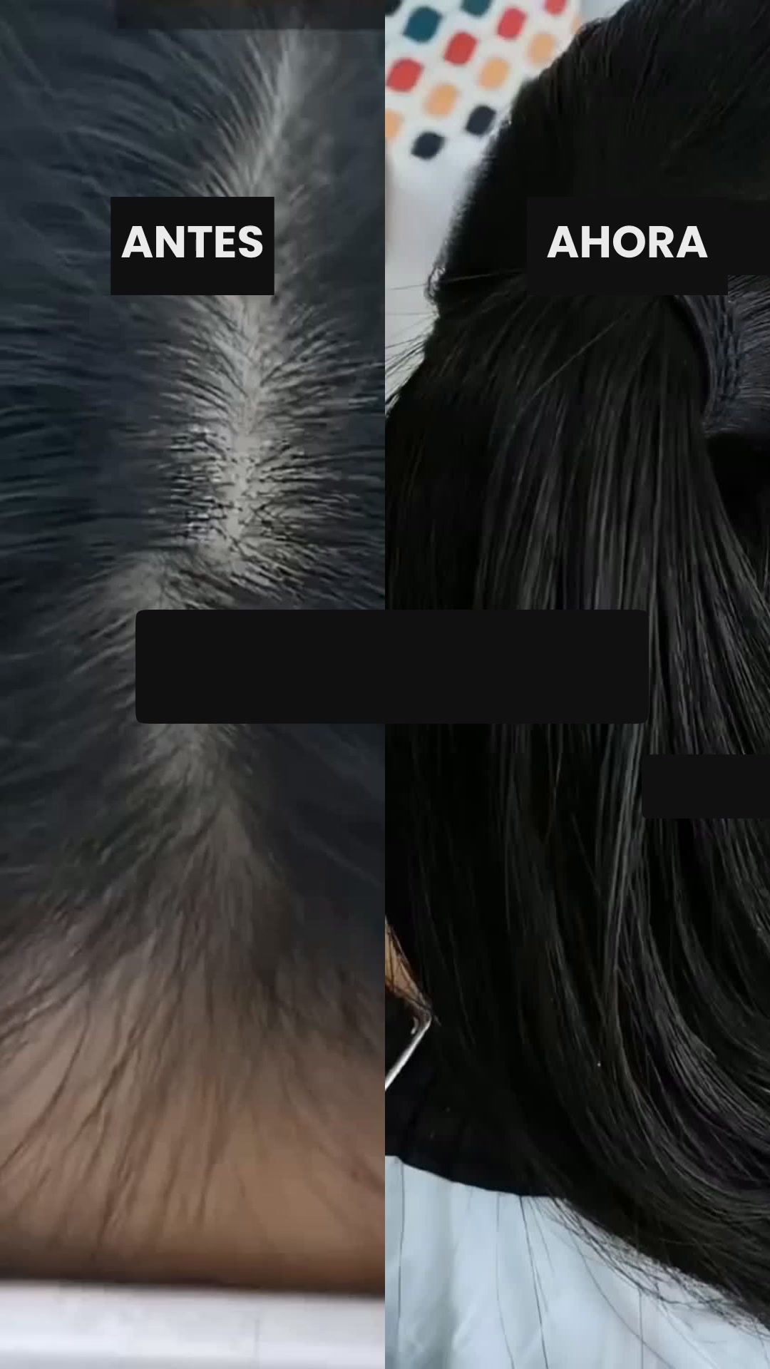 Cabello Más Abundante y Fuerte