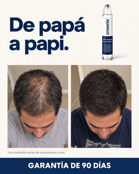 Roll-On para Crecimiento Capilar | Crownix