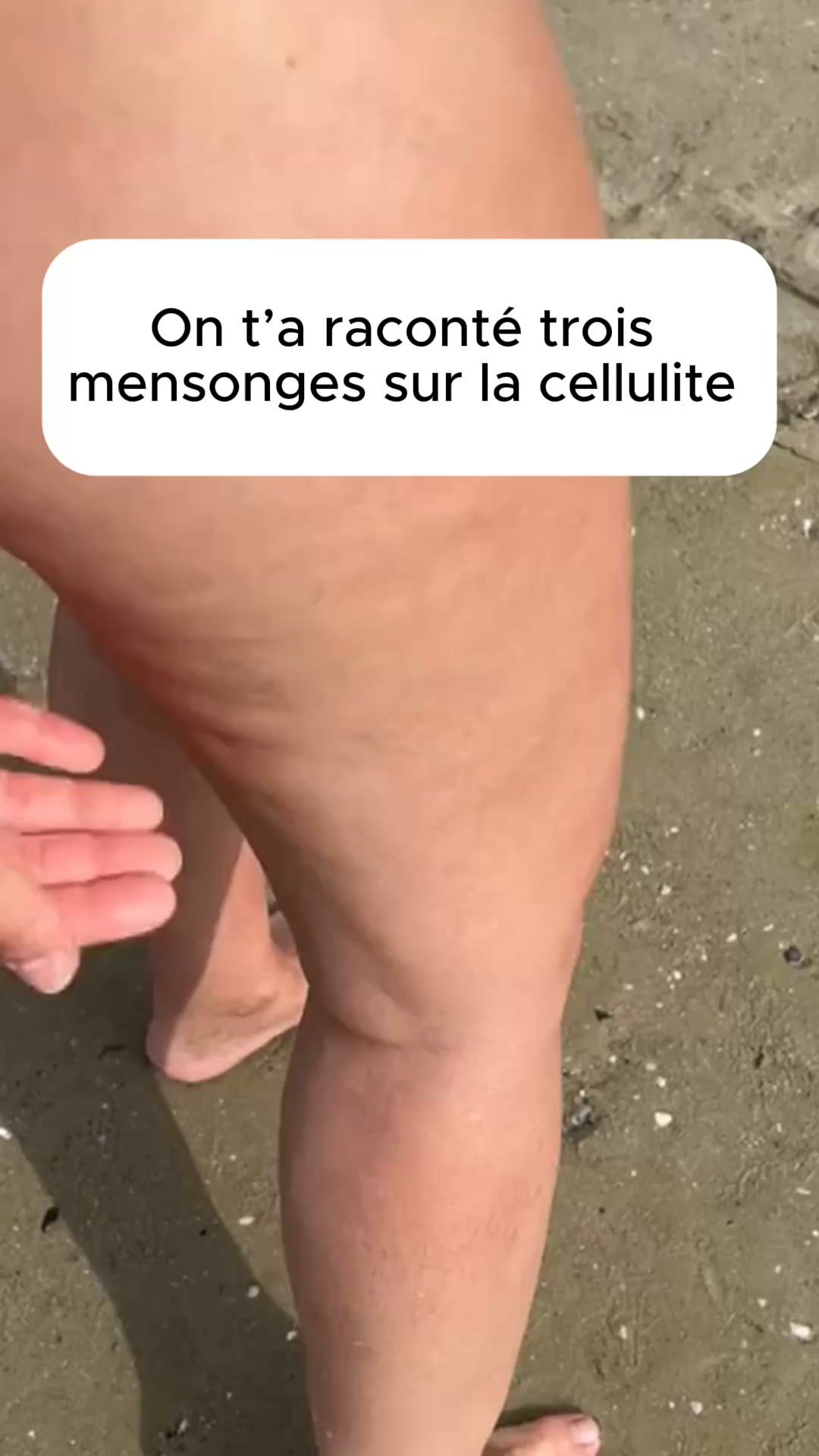 Éliminez la cellulite sans effort !