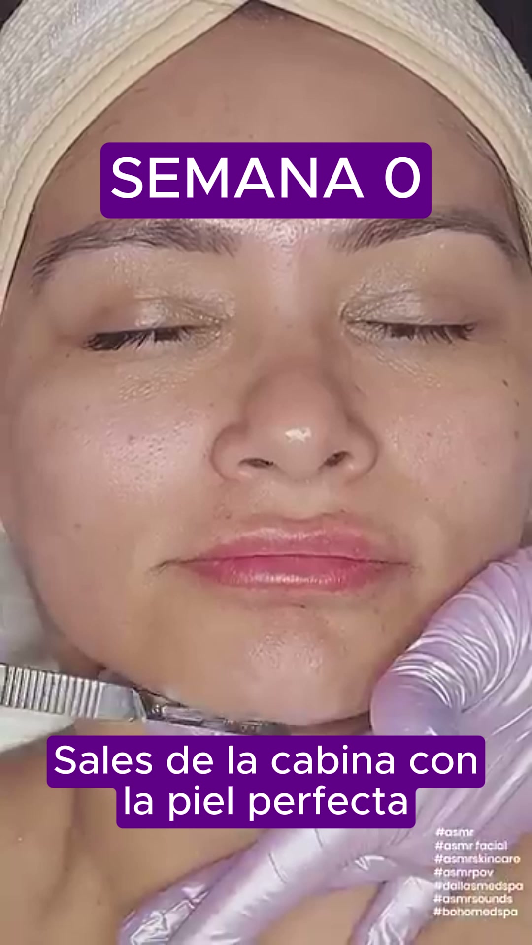 Dermaplaning en casa — 74,99 € Sin cera, sin tirones, sin cortes, en unos minutos, una vez por semana.