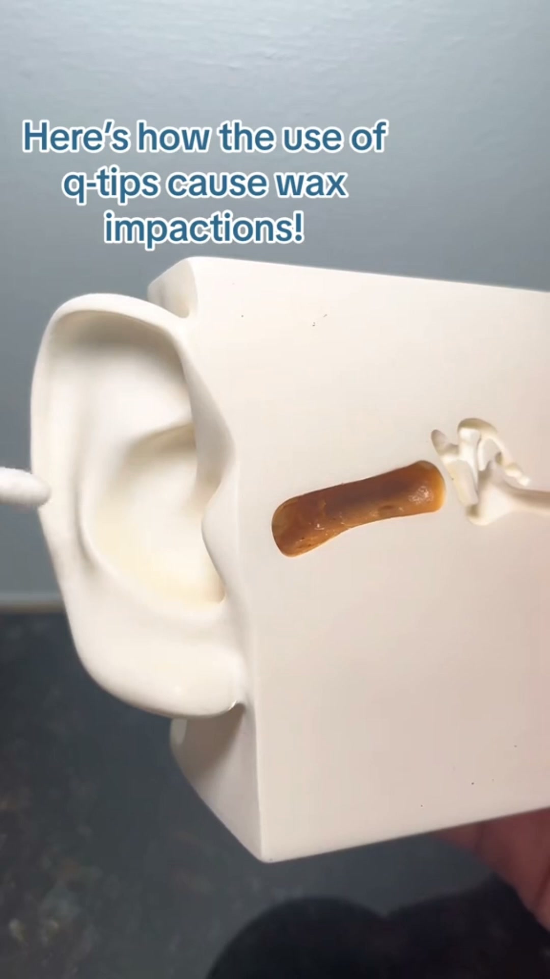 1080P Ear Wax Removal Camera