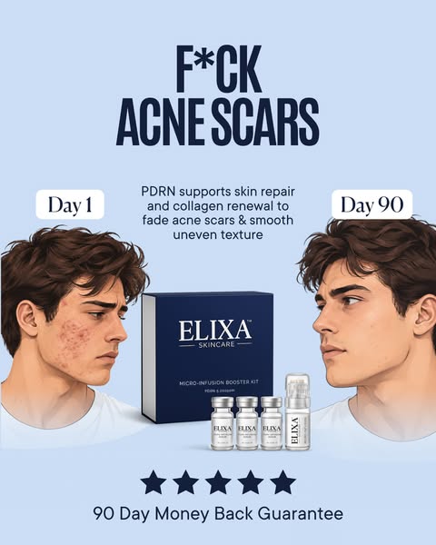 Learn the benefits of PDRN for Acne Scars