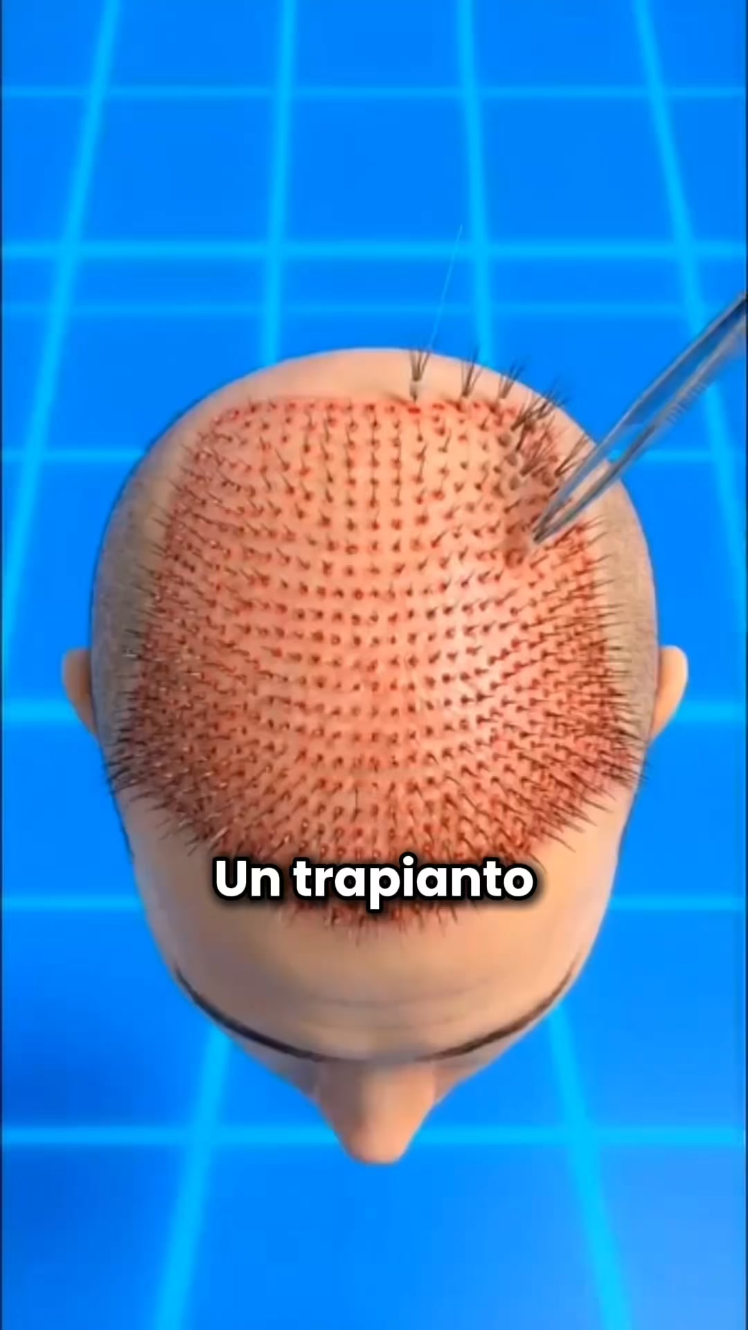 Dopo anni di diradamento, ho trovato la mia soluzione definitiva: Firmelià.