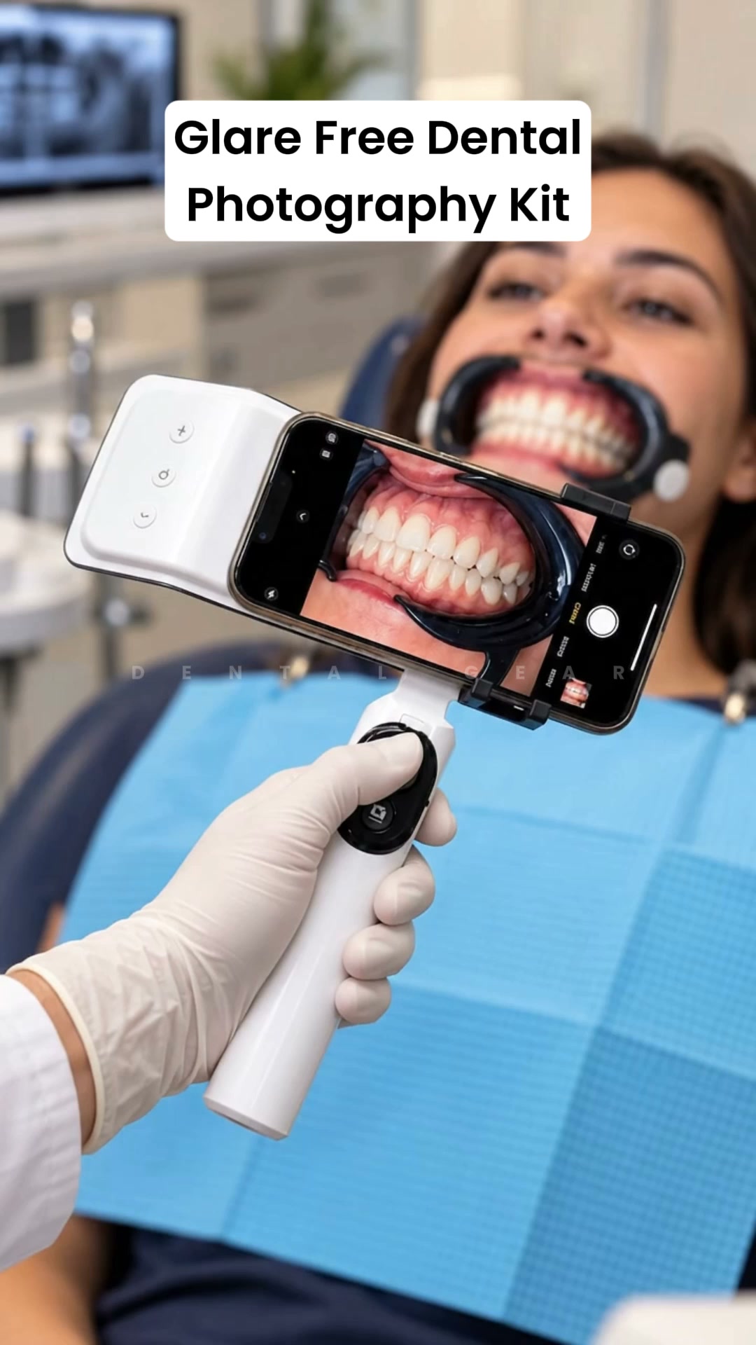 Glare Free Dental Photography Kit