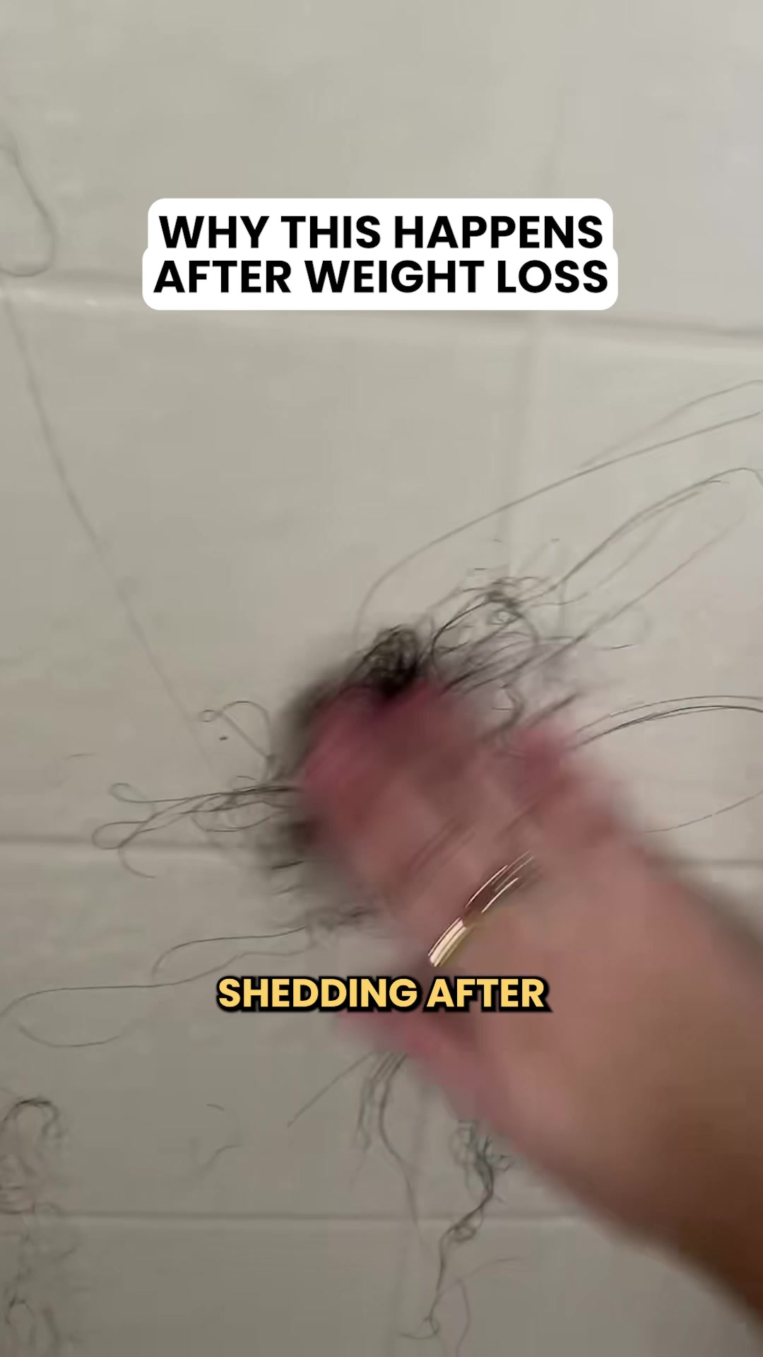 Weight Loss Hair Shedding?