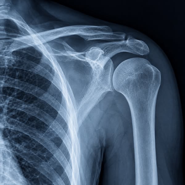 Chronic shoulder pain after 45 = the gap nobody's trained to fill