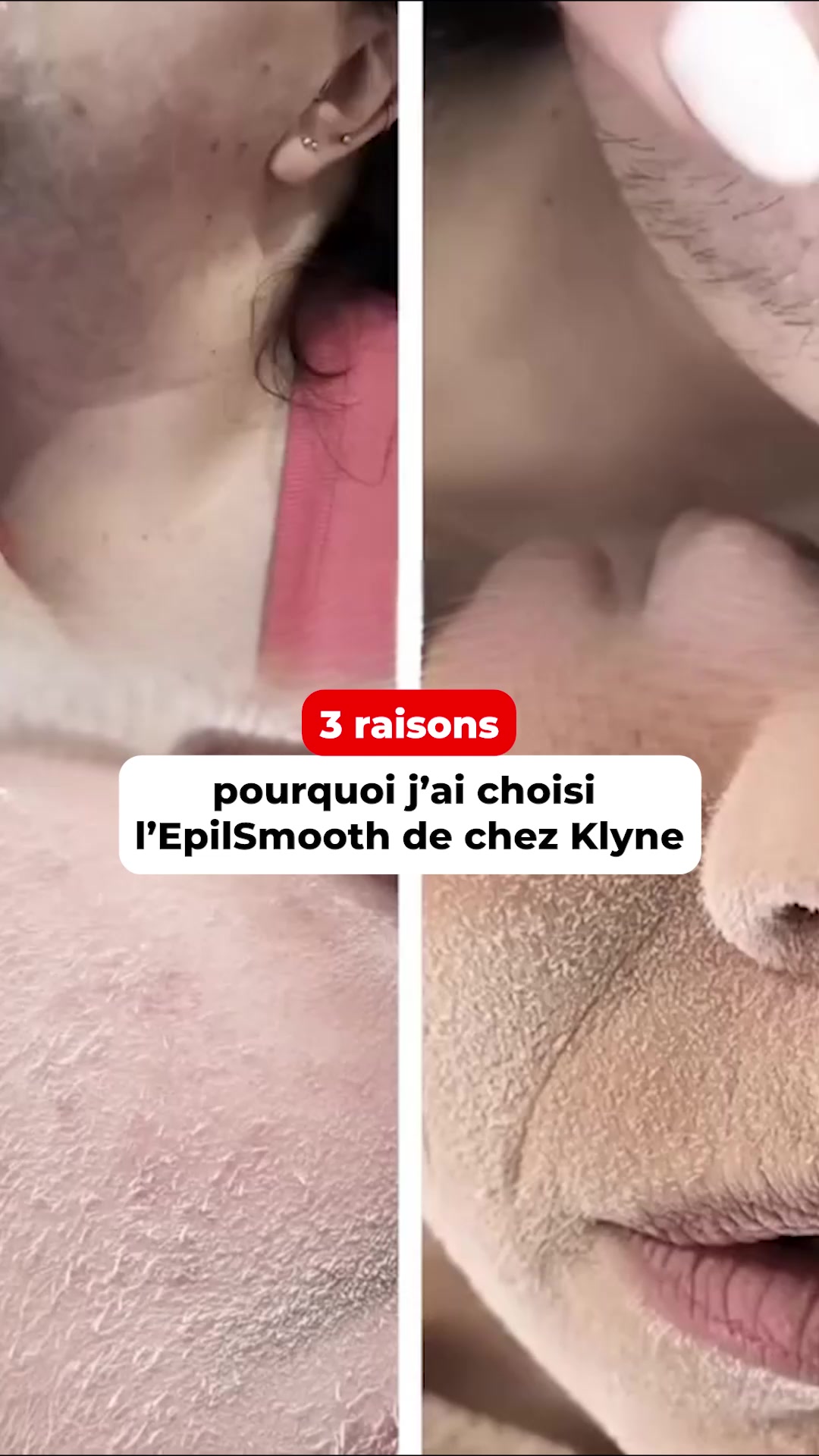 ENFIN un visage sans irritation !