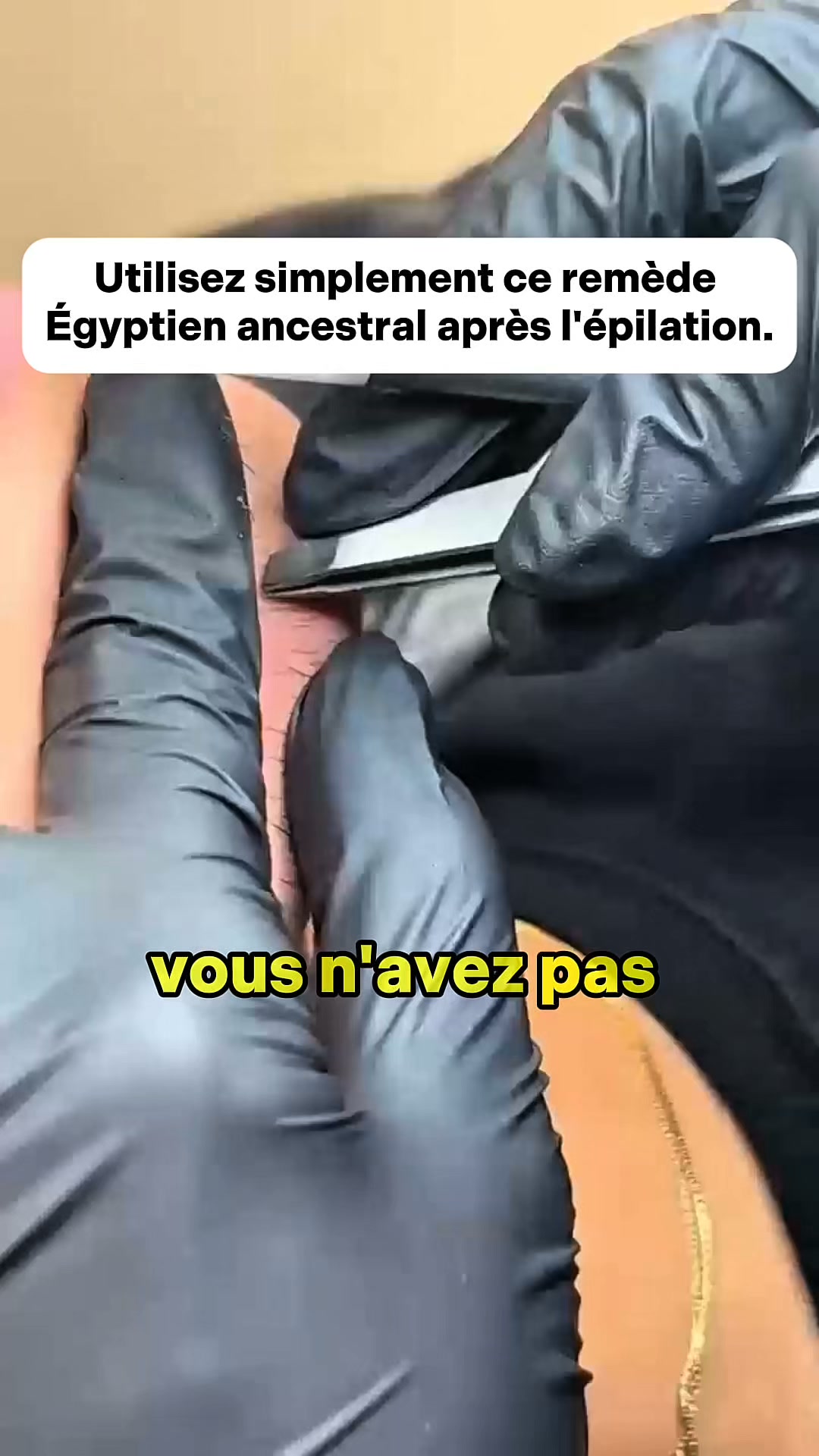 Empêchez vos poils du menton de repousser.