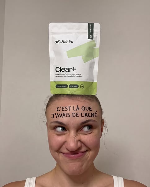 Tout essayé. Ça a vraiment marché.