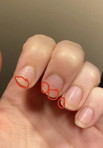 Read this if your nails are splitting...