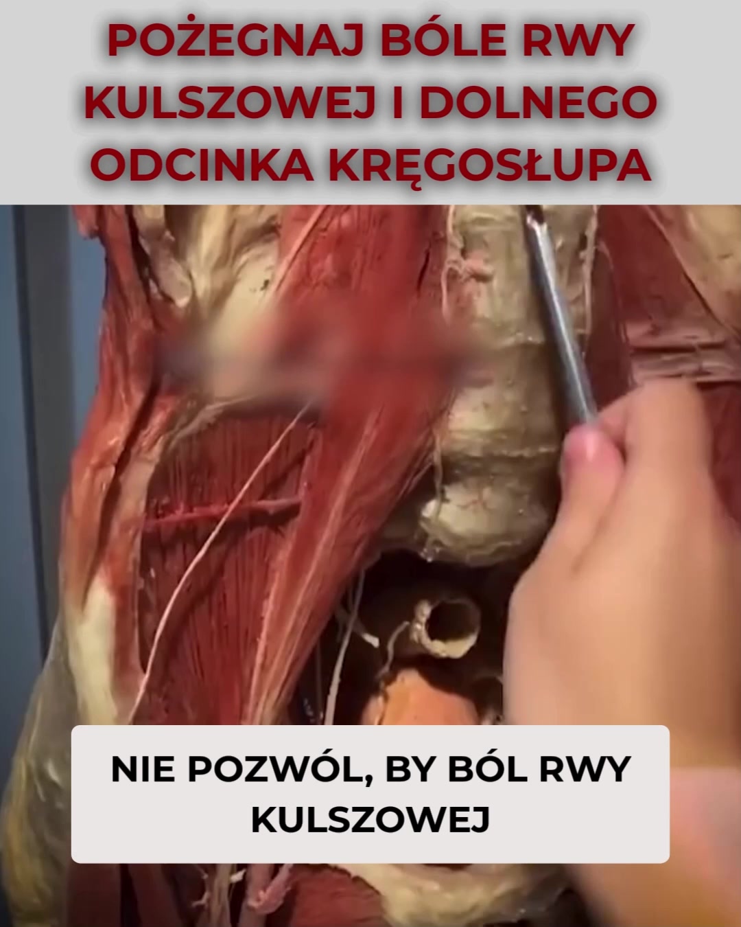 Pożegnaj ból pleców