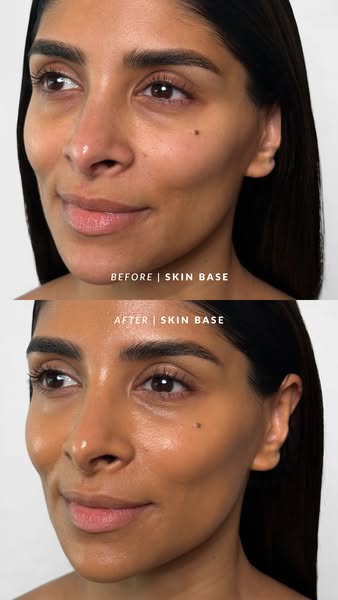 Skin Base