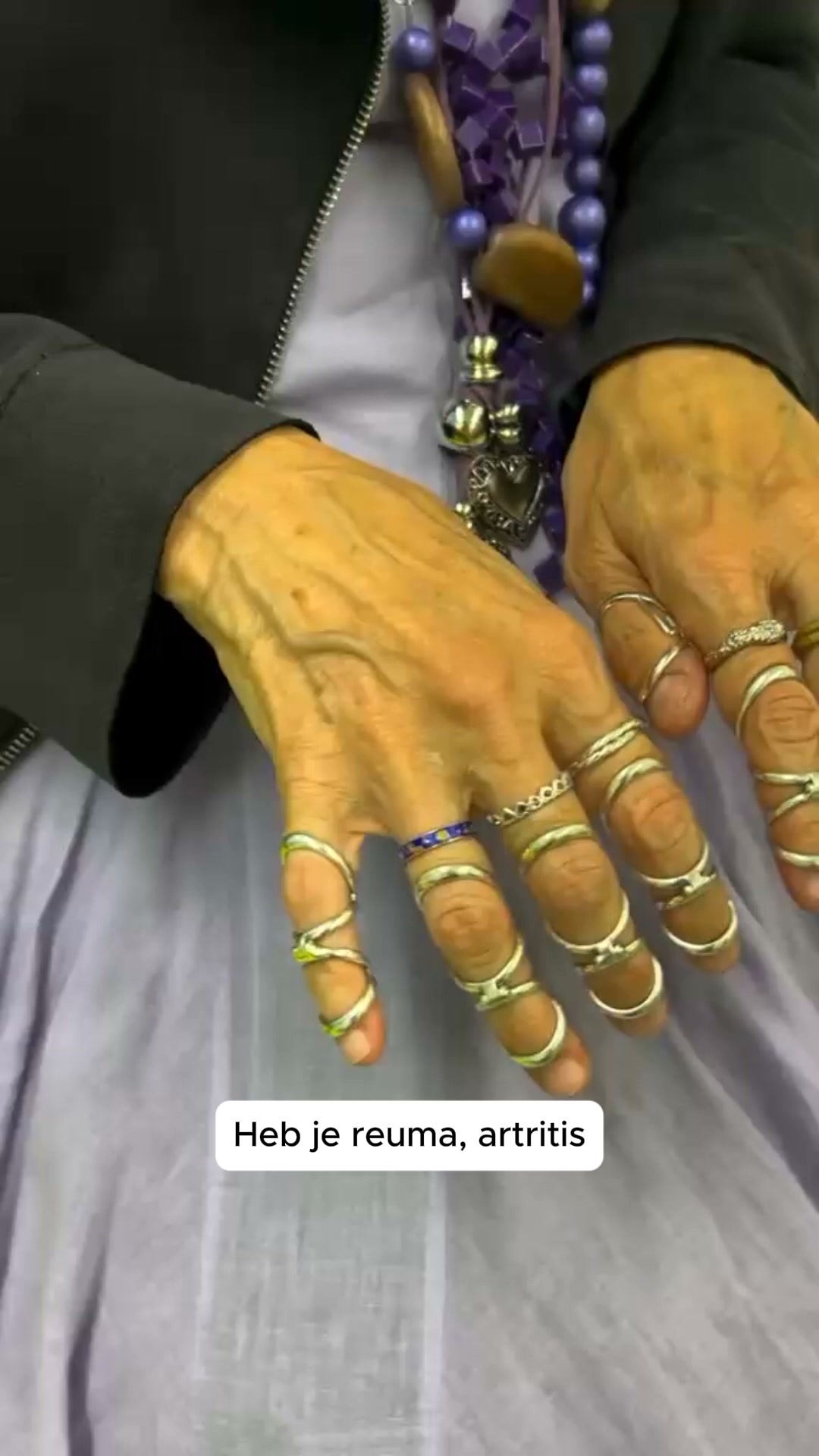 Je handen soepel en pijnvrij met de met de 3-in-1 Novren WarmRelief™ Handschoen