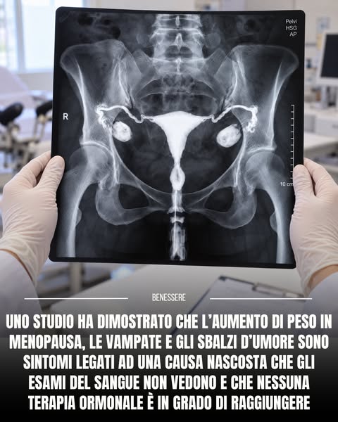 La verità sul grasso ormonale in menopausa