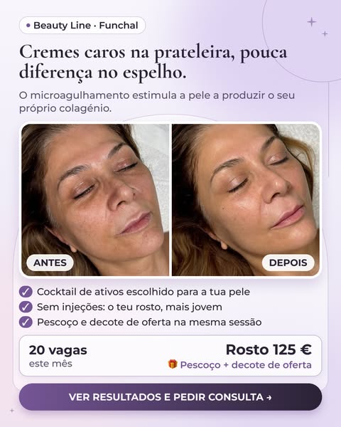 Vê os resultados reais no site