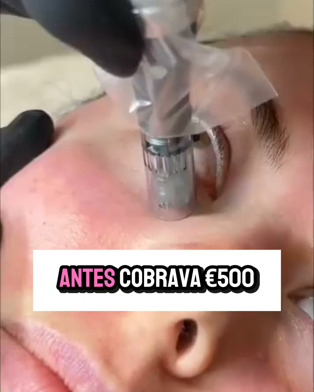 Pago Na Entrega