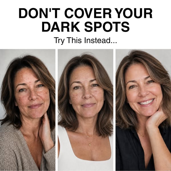 The Dark Spot Myth: The Real Reason Spots Keep Coming Back