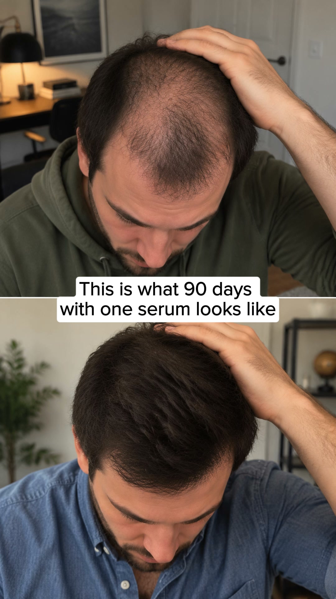 Korean Scalp Science, No Rx Needed