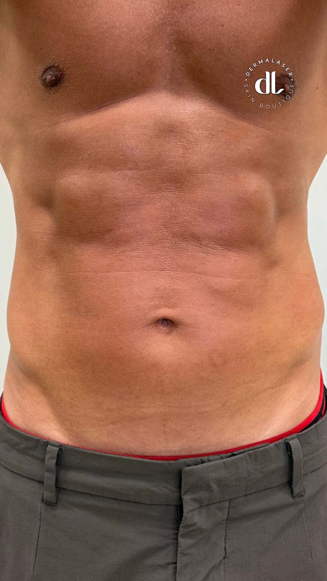 Anúncio de Dermalaser Skin Boutique