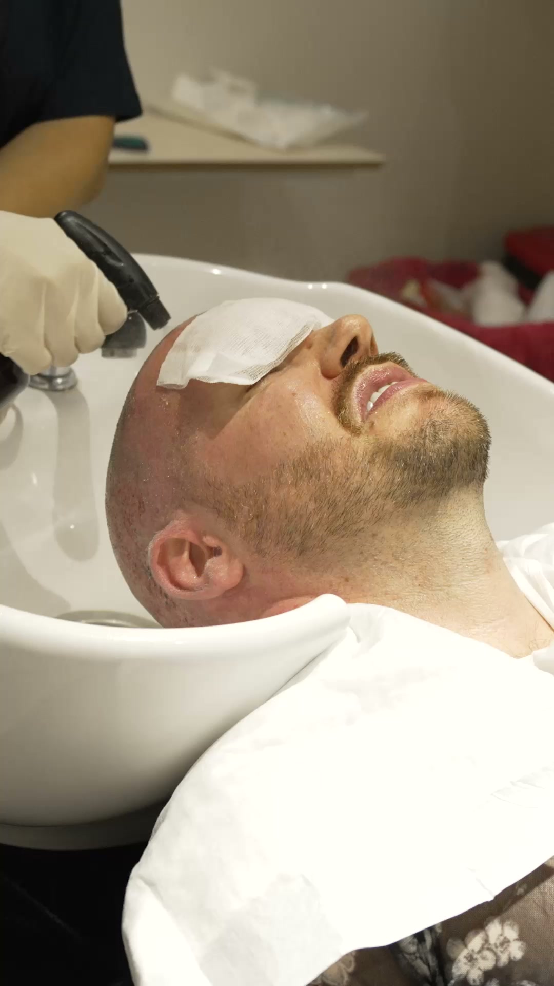 Hair Transplant in Turkey