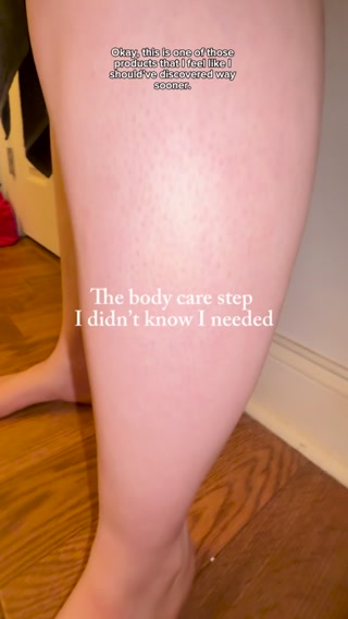 Cover the veins. Not your legs.