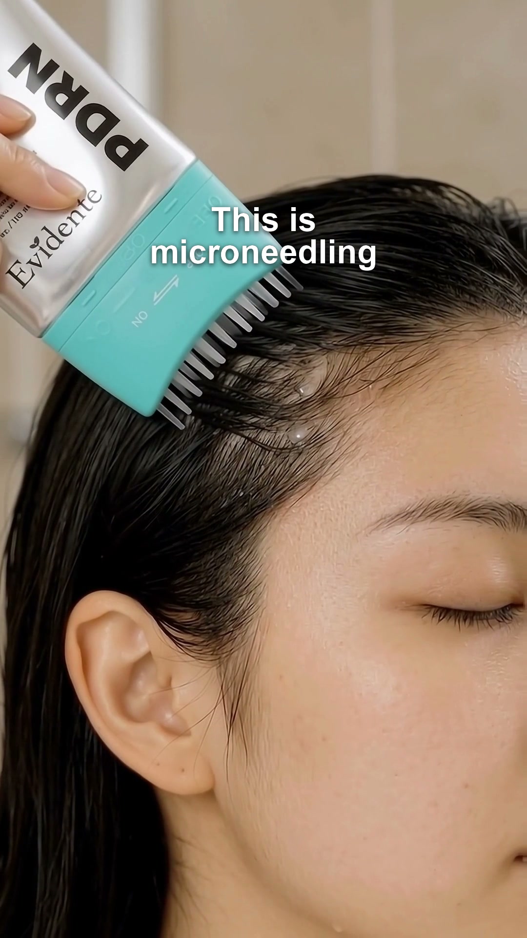 Microneedling for Your Scalp, Without the Needle