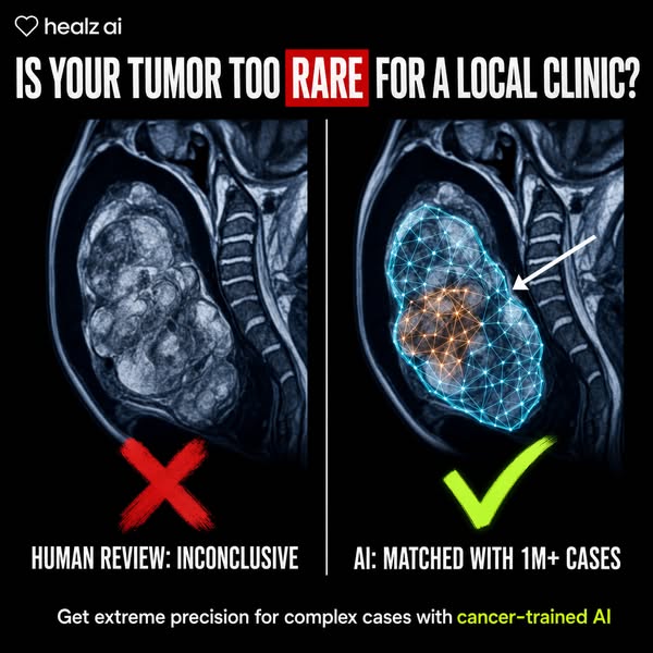 Get More Clarity About Your Cancer Care