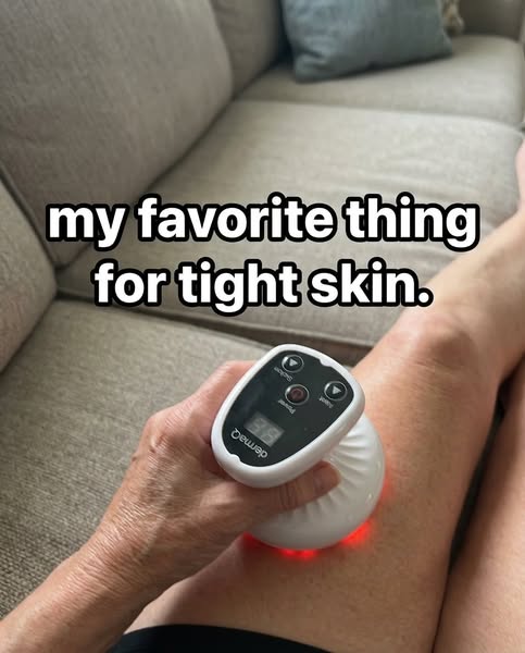 my skin is so tight