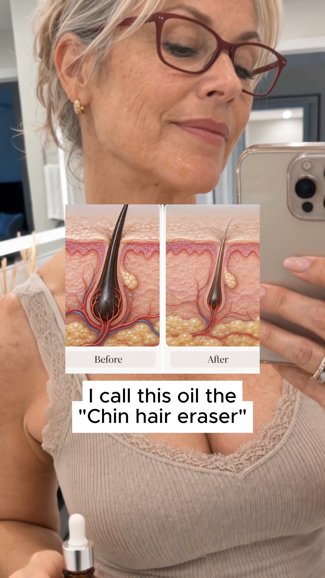 Still Dealing With Stubborn Chin Hair?